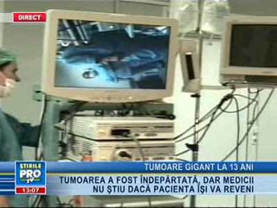 Fetiţă de 13 ani, operată de o tumoare de cinci kilograme