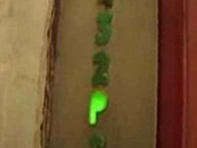 O femeie a rămas fără trei degete, după ce liftul i-a zdrobit falangele