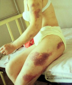 O femeie violata de doi indivizi a scapat dupa ce acestia au adormit