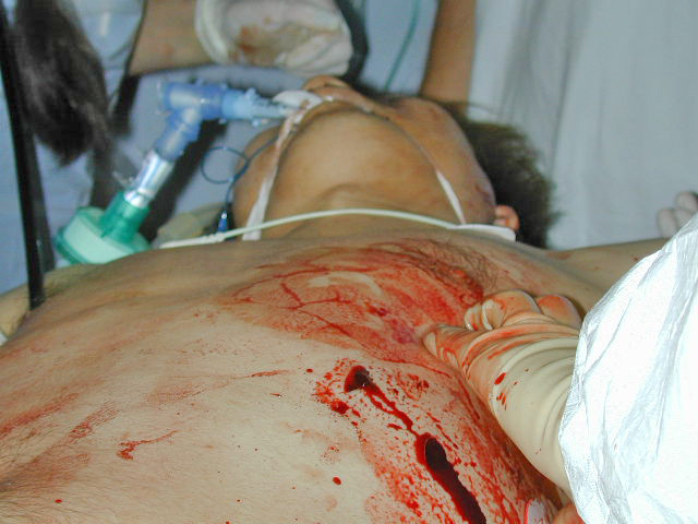 Roman injunghiat la Milano!