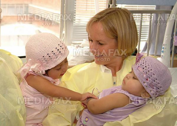 3 milioane de dolari costa operatia de separare a siamezilor din Brasov