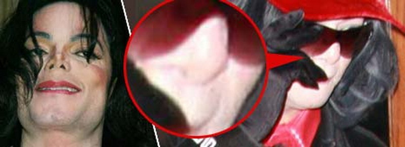 Michael si-a facut cadou un nas nou!