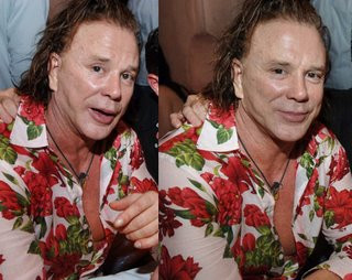 Ce-a fost si ce-a ajuns! Mickey Rourke, macinat de operatiile estetice
