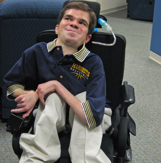 Sperante pentru noi tratamente in cazul distrofiei musculare