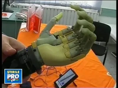 Bratul de robot, cunoscut sub numele de mana bionica, a ajuns in Romania