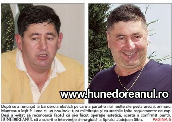 Primarul Devei a apelat la chirurgie estetica pentru a-si indrepta urechile