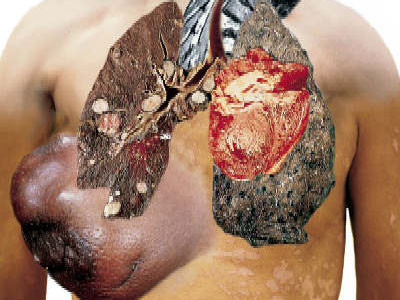 E momentul sa va lasati de fumat! Pachetul de tigari, cu 1 leu mai scump