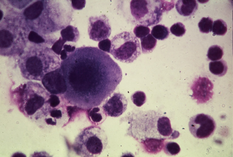 Cercetatorii, niste misogini! Spalatul podelelor apara femeile de cancer