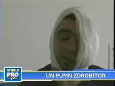 A ajuns la spital desfigurat, dupa ce s-a certat cu un amic!