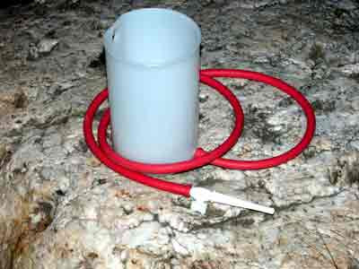 Medicul i-a recomandat unui barbat spalaturile vaginale!