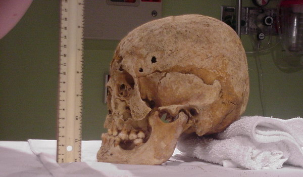 Oseminte de om, acoperite cu o mocheta, gasite in curtea unui dambovitean