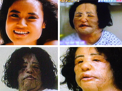 Dezbatere: Cat de mult ai fi dispus sa-ti modifici infatisarea?