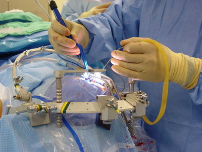 Acuzatii de malpraxis dupa moartea unei tinere de 19 ani