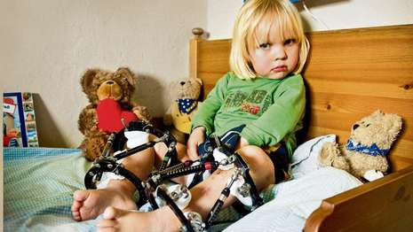 Durere fara margini! Ii rup oasele ca sa creasca