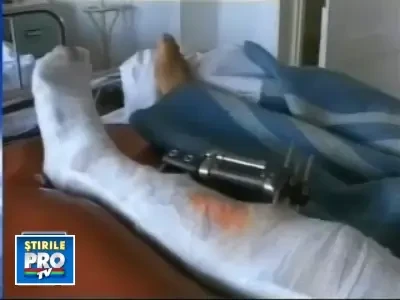 S-a ales cu o secure in picior pentru ca nu i-a gatit sotului