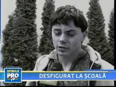 Desfigurat pentru o nuielusa de Mos Nicolae!