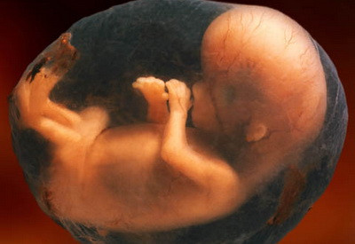 O familie acuza spitalul din Deva de malpraxis, dupa ce le-a murit copilul