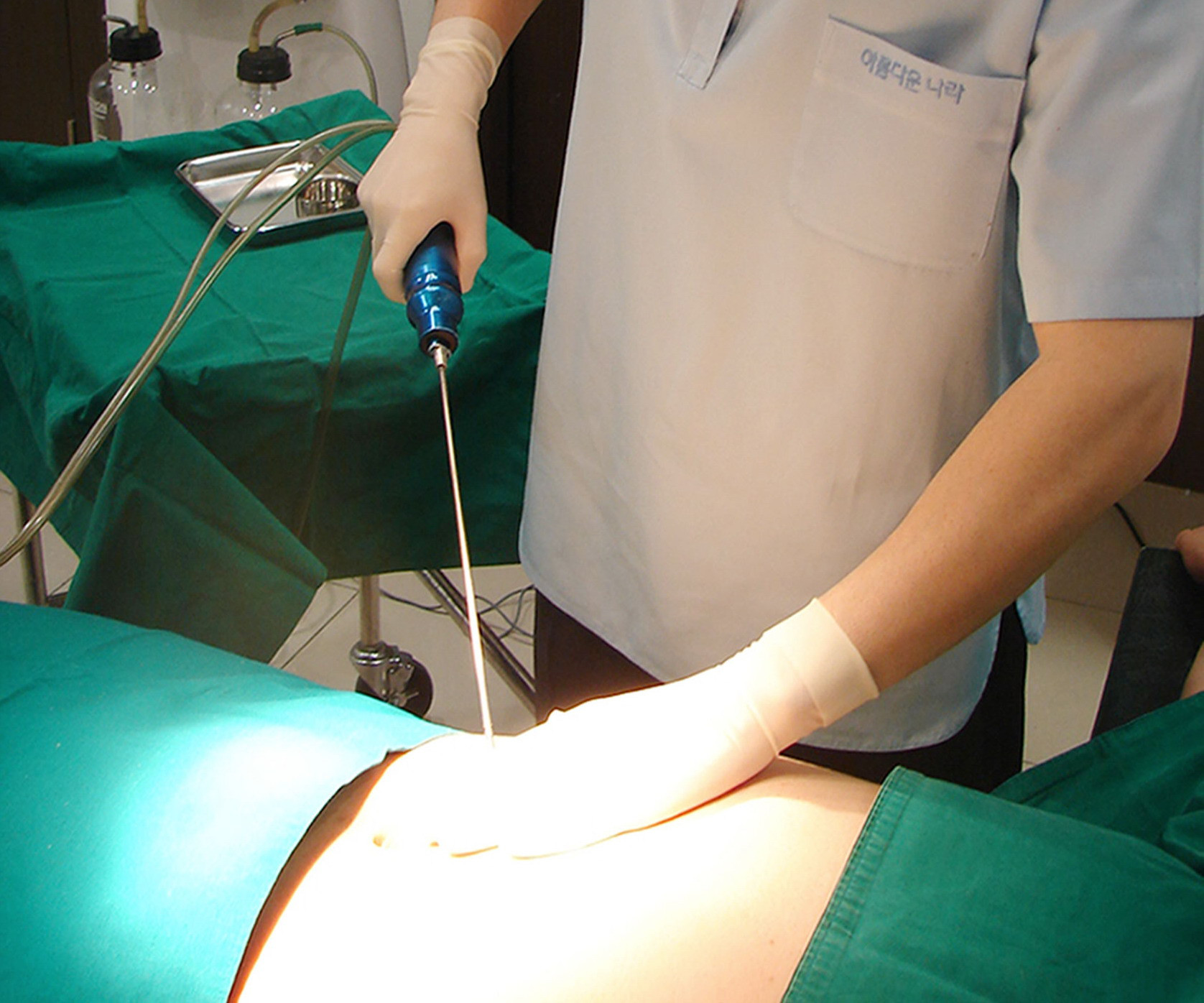 Si-a vandut gemenii pentru a-si face o liposuctie!