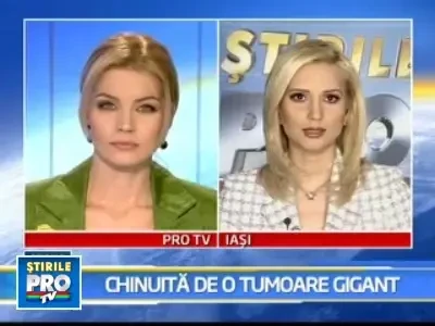 Caz uluitor la Iasi: tumora de 25 de centimetri pe gatul unei femei