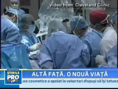Premiera medicala in SUA! Transplant de fata realizat in proportie de 80%!