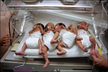 Patru bebelusi dintr-un foc! Se intampla o data la 512.000 de cazuri!