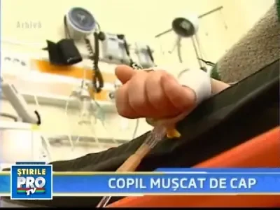 Un copil e in stare grava dupa ce a fost muscat de cap de un Rottweiler