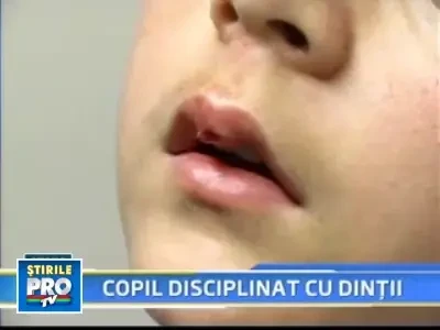 Gest "parintesc": a pedepsit un copil muscandu-l de buze