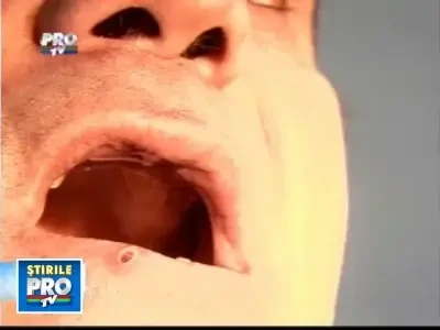 Romania te iubesc: Cu dintii-n farfurie dupa o simpla vizita la dentist!