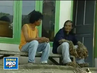 Dede Koswara: "omul-arbore" din Indonezia!