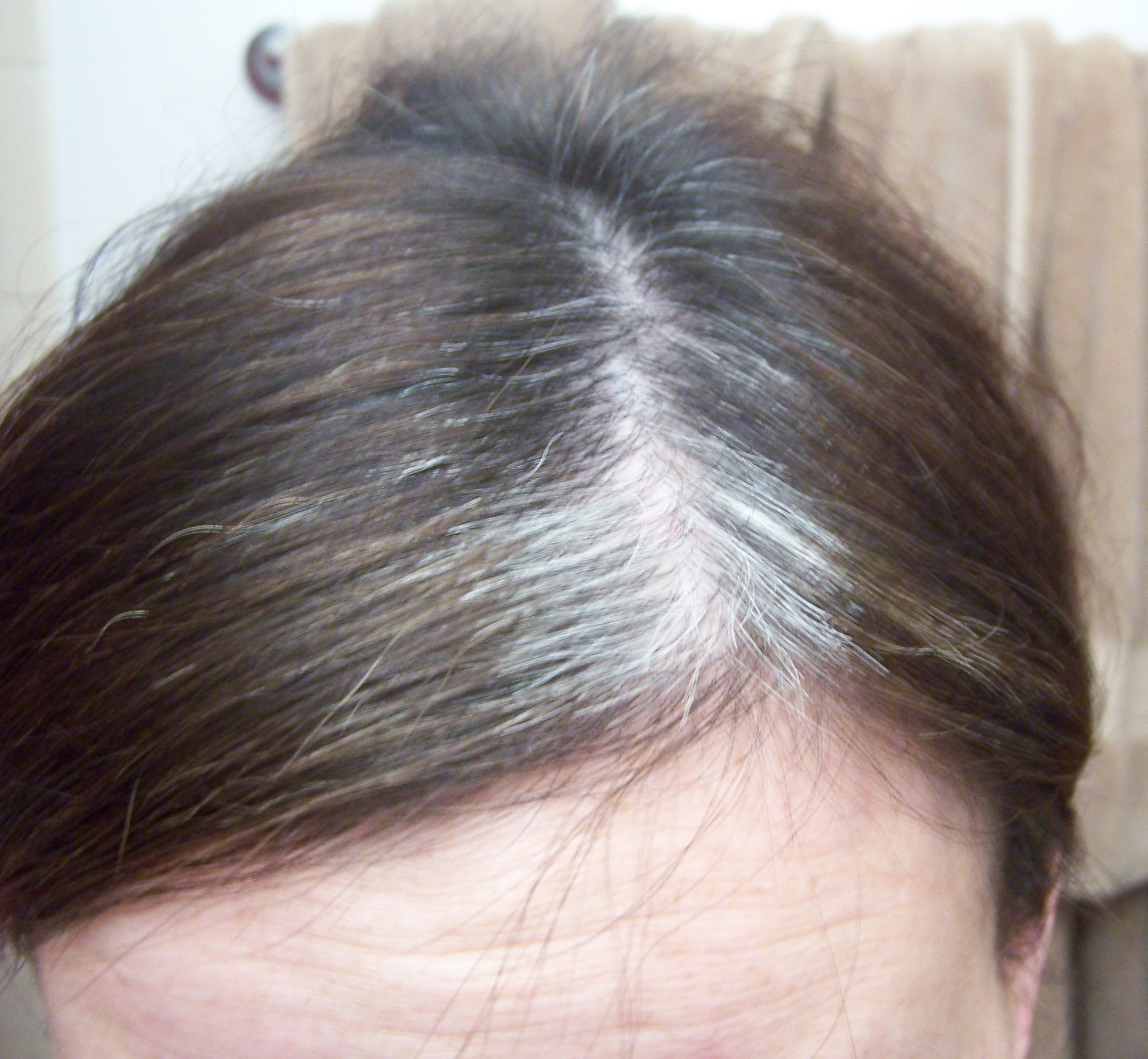 De ce ne ies peri albi?