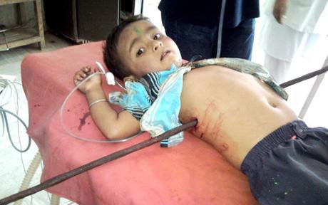 Un copil a supravietuit dupa s-a infipt de-a dreptul intr-o bara de 1,5 m