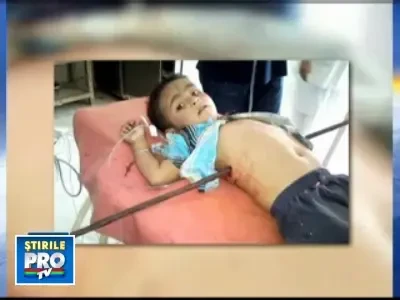 Miracol! Doi copii au supravietuit cu bucati de metal infipte in trup