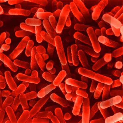 Legioneloza, cea mai noua boala monitorizata de specialisti