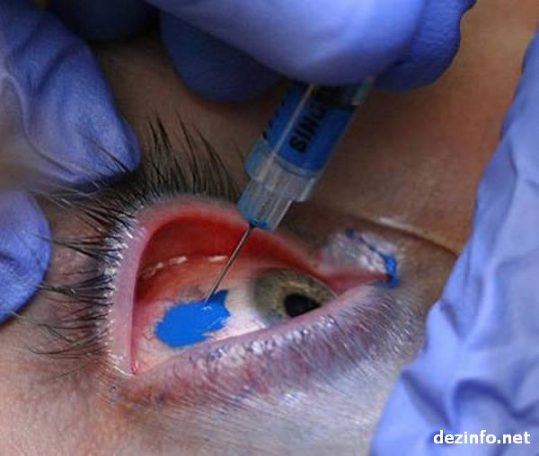 Tatuajele sunt de moda veche! Acum, tinerii se cioplesc de-a dreptul!