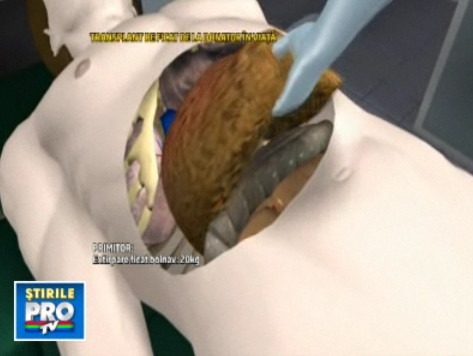 Informatii oficiale despre transplantul lui Cristi Minculescu