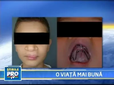 Malformatiile la nivelul fetei, tratate si in Romania!