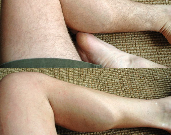 Ultima moda in epilare: cu ata sau cu zahar