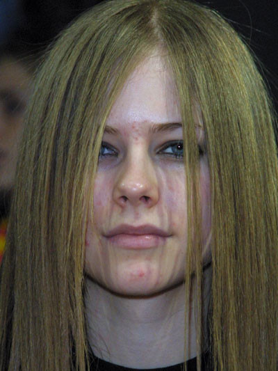 Fata urata a celebritatilor! O GALERIE FOTO cu adevarat infricosatoare!