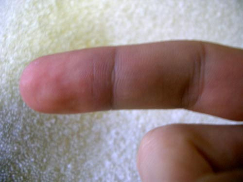 Au fost concediati, iar in semn de protest isi amputeaza degetele!