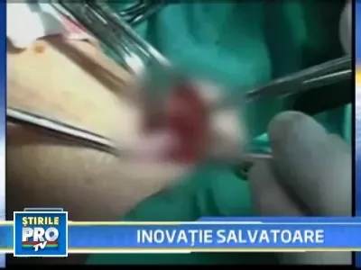 Vene si artere noi, crescute chiar din celulele pacientului