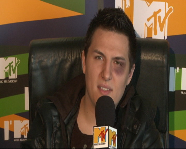 Gabi Huiban prezinta MTV “Euro Top 20”, cu un ochi vanat!