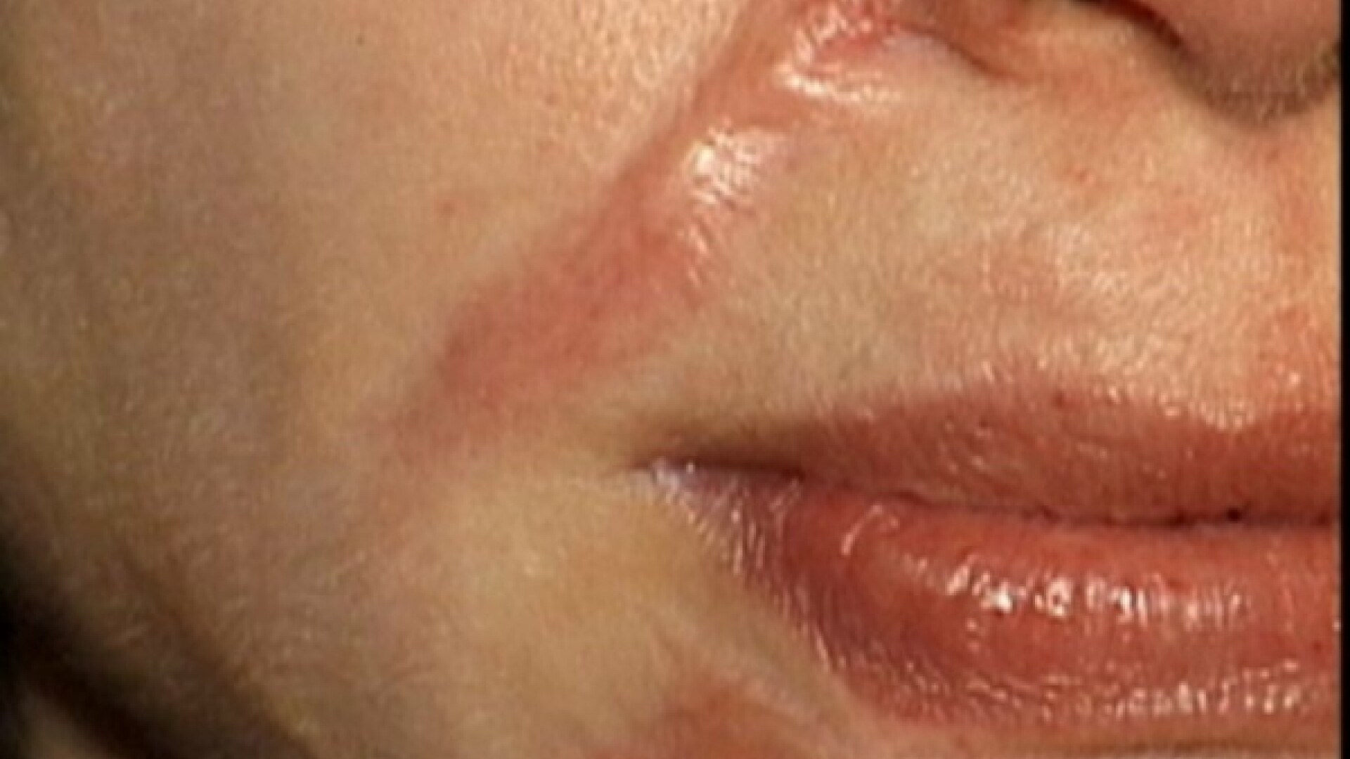 CSID: Cicatricele inestetice pot avea un impact major asupra psihicului