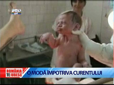 Romania, te iubesc: cezariana, o practica la moda printre mamicile romance