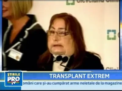 INCREDIBIL! Dupa transplantul de fata, pare ca s-a nascut a doua oara!
