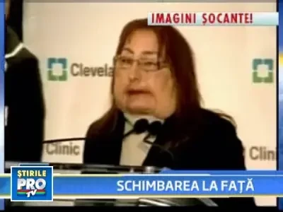 INCREDIBIL! Dupa transplantul de fata, pare ca s-a nascut a doua oara!
