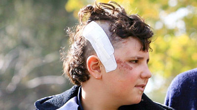 Australia: salvat de la moarte de o masina electrica de gaurit