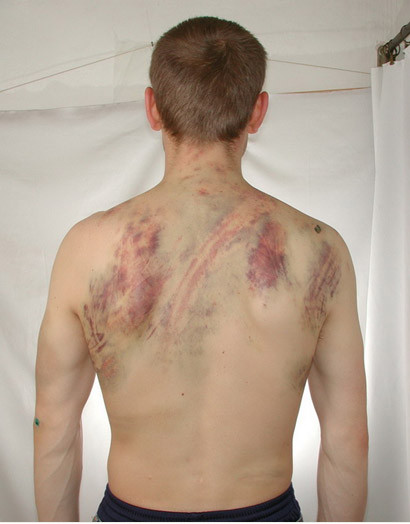 Scandal in Serbia! Batuti crunt, intr-un centru de reabilitare al Bisericii