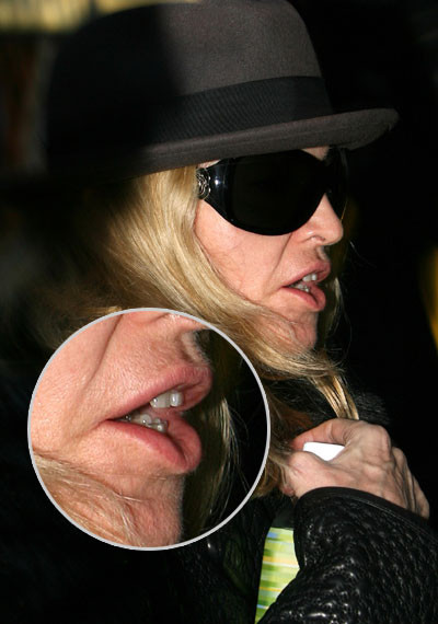 SOCANT! Madonna si-a scos la plimbare... bratele!