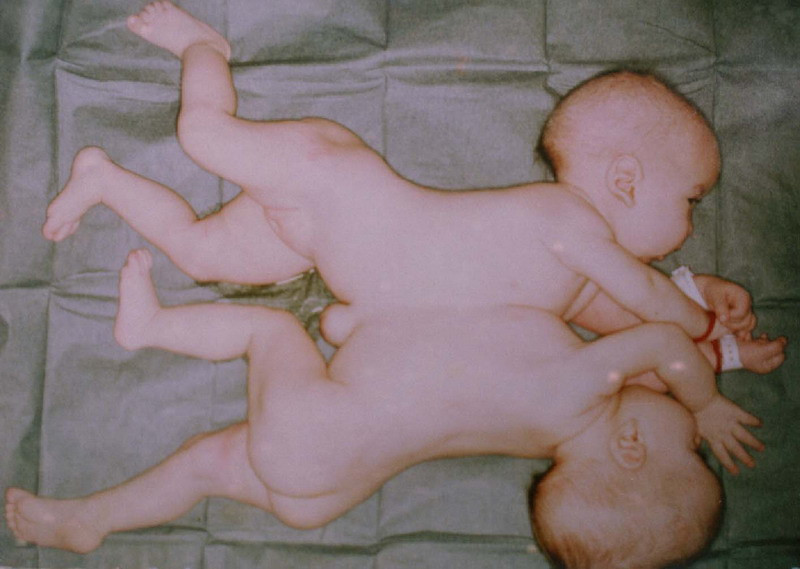 Celebrele siameze ale anilor ’80, Lina si Gherghina, vin la "Happy Hour"