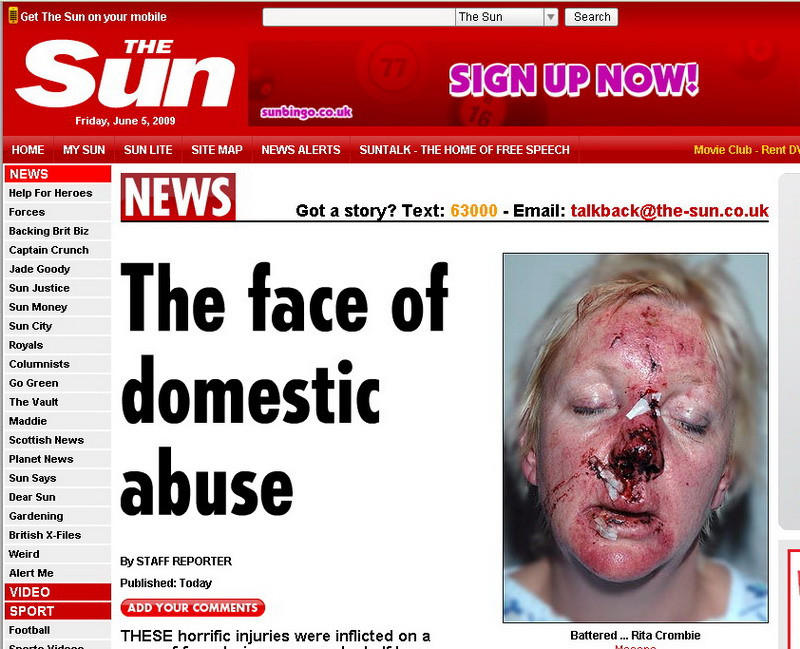 IMAGINE DE GROAZA! Asa arata o femeie dupa ce a fost agresata 90 de minute!